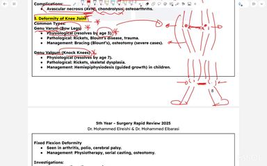 deformity of knee joint