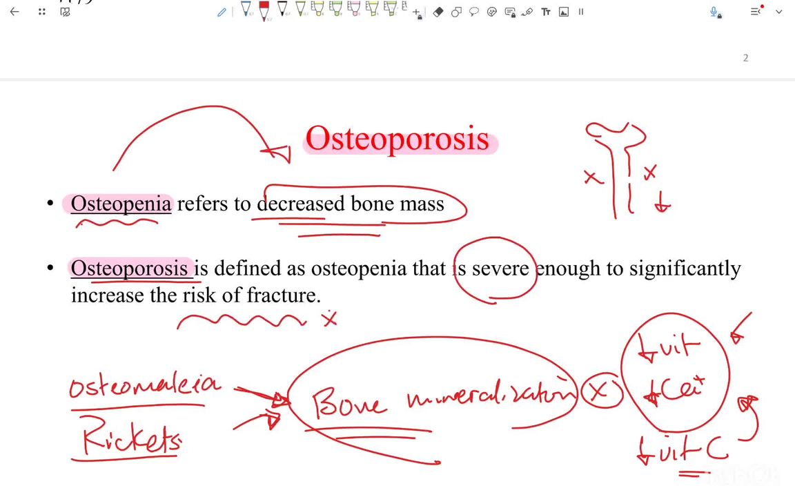 Metabolic bone diseases 2