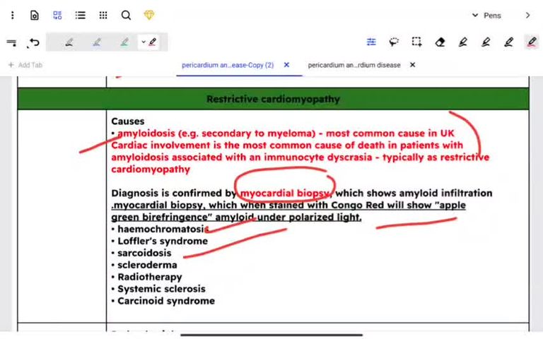 Restrictive cardiac myopathy and myocarditis