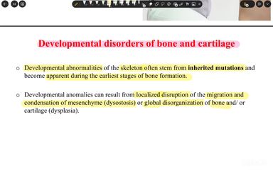 Congenital bone diseases