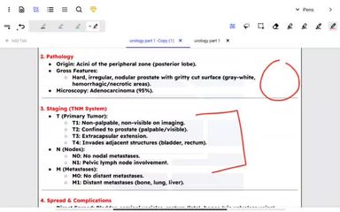 prostate disease part 2