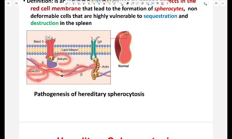  Hemolytic anemia part 2