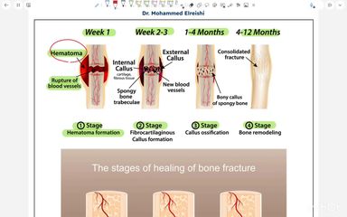 PBL OBJECTIVES - PART 4