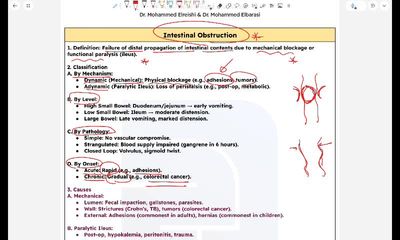 intestinal obstruction