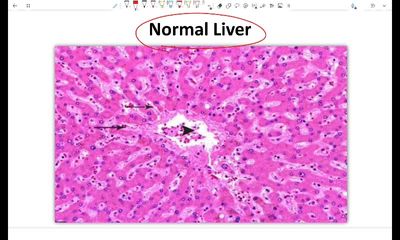 W5 - Cell injury and adaptation