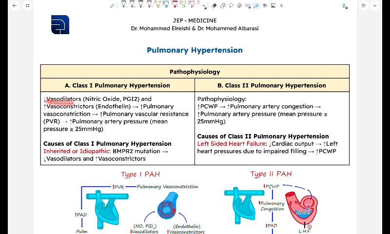 Pulmonary hypertension