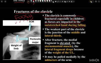 Clavicle, scapula and humerus part 2