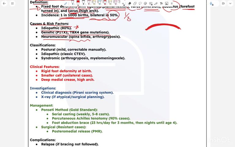 congenital talipes equinovarus