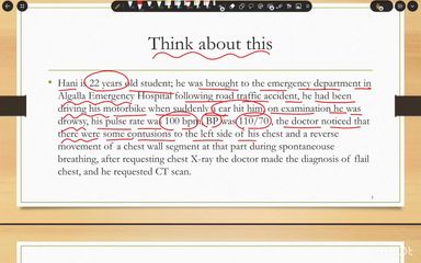 Bones of thorax and intercostal spaces