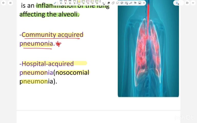 Respiratory tract infections