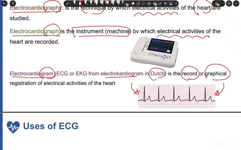 W2- ECG