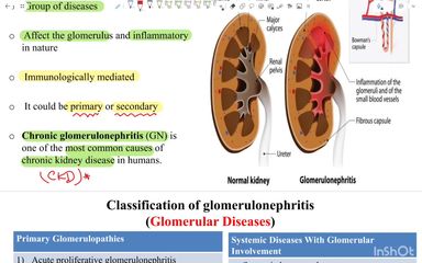 Glomerular diseases - part 1