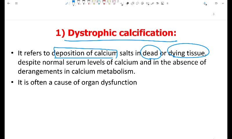 pathological calcification