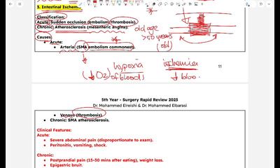 intestinal ischemia