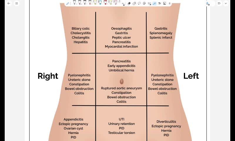 Abdominal pain part 1