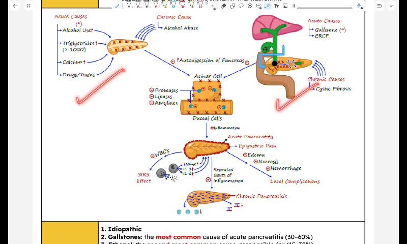 GIT 7 - Acute pancreatitis