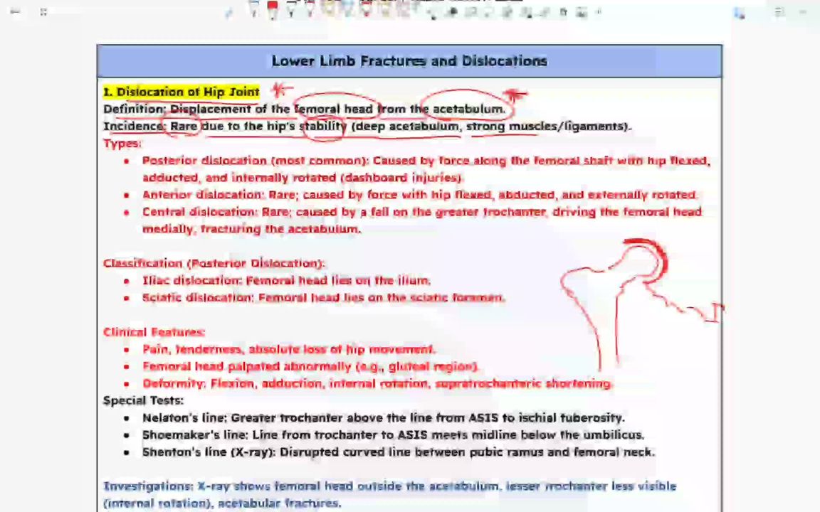 dislocation of hip joint