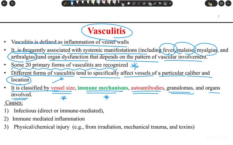 Vasculitis