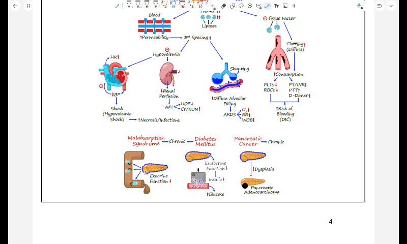 GIT 8 - Chronic pancreatitis